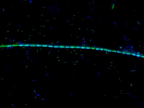 schwarzer Hintergrund, in der Mitte eine grün-blau leuchtende Kette aus Bakterien von rechts nach links