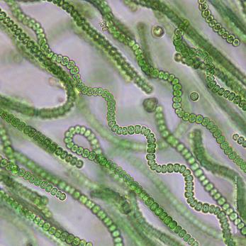 auf hellem Untergrund liegen parallel und sich überlagernde hellgrüne Stäbchenbakterien