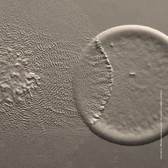 graue Fläche mit zwei sich schneidenden Kreisen aus zwei Bakterienkolonien